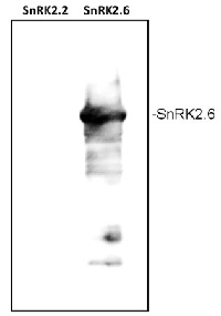 SRK2E | Ser/Thr-protein kinase SnRK2,6 in the group Antibodies Plant/Algal  / Developmental Biology / Signal transduction at Agrisera AB (Antibodies for research) (AS13 2635)
